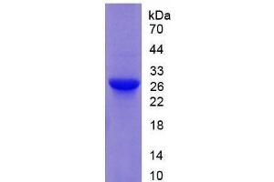 Image no. 1 for Glutathione S-Transferase mu 1 (GSTM1) (AA 1-218) (Active) protein (His tag) (ABIN6239877)