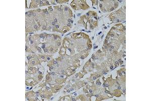 Immunohistochemistry of paraffin-embedded human stomach using TRPC3 antibody. (TRPC3 anticorps)