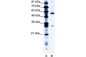 WB Suggested Anti-CORO1A Antibody Titration:  1. (Coronin 1a anticorps  (C-Term))