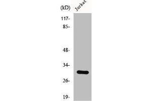 Western Blot analysis of LOVO cells using CSP Polyclonal Antibody (DNAJC5 anticorps  (C-Term))