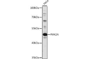Western blot analysis of extracts of HeLa cells, using PI4K2A antibody (ABIN7269284) at 1:1000 dilution.