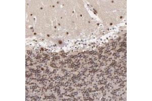 Immunohistochemical staining of human cerebellum with NCOR2 polyclonal antibody  shows strong moderate nuclear positivity in Purkinje cells, cells in molecular layer and cells in granular layer. (NCOR2 anticorps)
