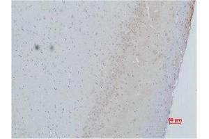 Immunohistochemistry (IHC) analysis of paraffin-embedded Rat Brain Tissue using CACNG2 Polyclonal Antibody.