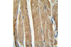 Immunohistochemistry analysis in formalin fixed and paraffin embedded human skeletal muscle reacted with PGAM2 Antibody (N-term) followed which was peroxidase conjugated to the secondary antibody and followed by DAB staining. (PGAM2 anticorps  (N-Term))