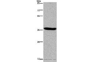 Western blot analysis of LO2 cell, using KCNK17 Polyclonal Antibody at dilution of 1:300 (KCNK17 anticorps)