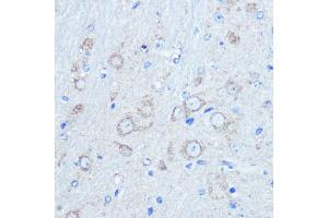 Immunohistochemistry of paraffin-embedded mouse brain using LC3B Rabbit pAb (ABIN6129924 and ABIN6143474) at dilution of 1:100 (40x lens). (LC3B anticorps)