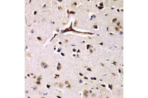 Immunohistochemistry of paraffin-embedded rat brain using EIF2AK4 antibody (ABIN5974303) at dilution of 1/100 (40x lens). (GCN2 anticorps)