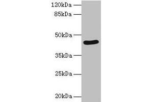 Western blot All lanes: SERPINB8 antibody at 2 μg/mL + Jurkat whole cell lysate Secondary Goat polyclonal to rabbit IgG at 1/10000 dilution Predicted band size: 43, 28, 23 kDa Observed band size: 43 kDa