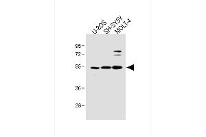 All lanes : Anti-LYK5 Antibody (N-term) at 1:2000 dilution Lane 1: U-2OS whole cell lysate Lane 2: SH-SY5Y whole cell lysate Lane 3: MOLT-4 whole cell lysate Lysates/proteins at 20 μg per lane.