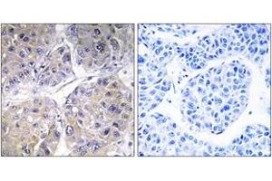 Immunohistochemistry (IHC) image for anti-Solute Carrier Family 27 (Fatty Acid Transporter), Member 5 (SLC27A5) (AA 481-530) antibody (ABIN2890164) (SLC27A5 anticorps  (AA 481-530))