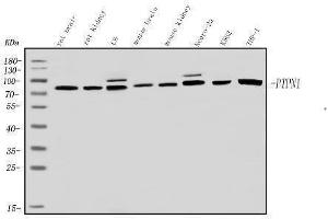 Western blot analysis of PNPT1 using anti-PNPT1 antibody (ABIN7599172).