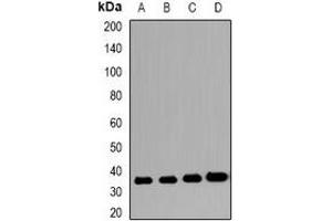 Western blot analysis of VSIG2 expression in LDL (A), PC3 (B), mouse stomach (C), rat stomach (D) whole cell lysates. (VSIG2 anticorps)