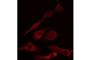 ABIN6275041 staining HuvEc cells by IF/ICC.