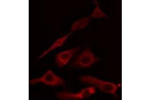 ABIN6275041 staining HuvEc cells by IF/ICC. (HSD11B1 anticorps  (N-Term))
