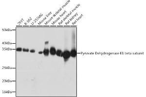 Western blot analysis of extracts of various cell lines, using Pyruvate Dehydrogenase E1 beta subunit Rabbit mAb (ABIN7269772) at 1:1000 dilution. (PDHB anticorps)