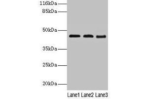 Western blot All lanes: BCAT2 antibody at 2 μg/mL Lane 1: NIH/3T3 whole cell lysate Lane 2: Mouse kidney tissue Lane 3: Mouse spleen tissue Secondary Goat polyclonal to rabbit IgG at 1/10000 dilution Predicted band size: 45, 34 kDa Observed band size: 45 kDa (BCAT2 anticorps  (AA 28-392))