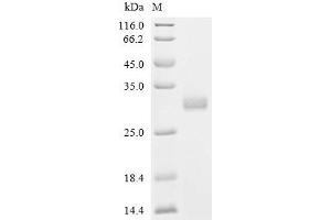 (Tris-Glycine gel) Discontinuous SDS-PAGE (reduced) with 5 % enrichment gel and 15 % separation gel.