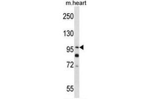 SULF2 Antibody (C-term) western blot analysis in mouse heart tissue lysates (35µg/lane). (SULF2 anticorps  (C-Term))