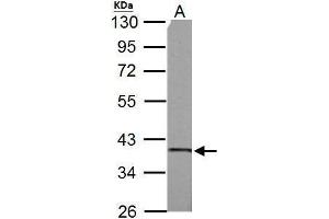 WB Image SUCLG1 antibody detects SUCLG1 protein by Western blot analysis.