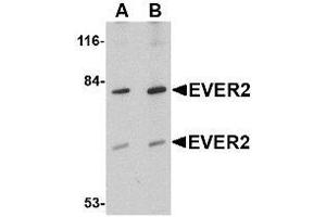 Western blot analysis of EVER2 in Jurkat cell lysate with AP30323PU-N EVER2 antibody at (A) 1 and (B) 2 μg/ml. (TMC8 anticorps  (Center))