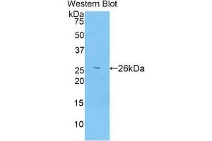 Detection of Recombinant ADAMTS12, Mouse using Polyclonal Antibody to A Disintegrin And Metalloproteinase With Thrombospondin 12 (ADAMTS12)