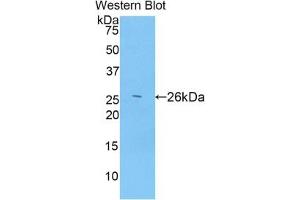 Detection of Recombinant ADAMTS12, Mouse using Polyclonal Antibody to A Disintegrin And Metalloproteinase With Thrombospondin 12 (ADAMTS12) (ADAMTS12 anticorps  (AA 1318-1538))