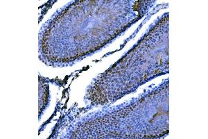 IHC analysis of KPNA2 using anti-KPNA2 antibody (ABIN7601936).