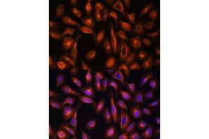 Immunofluorescence analysis of U-2 OS cells using Alpha Fodrin antibody (ABIN6128747, ABIN6148403, ABIN6148404 and ABIN6213643) at dilution of 1:100.