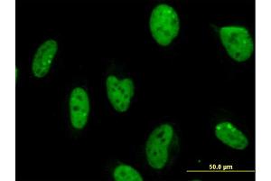 Immunofluorescence of monoclonal antibody to MPG on HeLa cell.