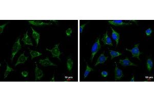 ICC/IF Image XIAP antibody [C1C3] detects XIAP protein at cytoplasm by immunofluorescent analysis.