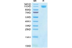 SDS-PAGE (SDS) image for SARS-CoV-2 Spike S1 (P.1 - gamma) protein (His tag) (ABIN7274778)