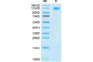 SARS-CoV-2 Spike S1 (Gamma P.