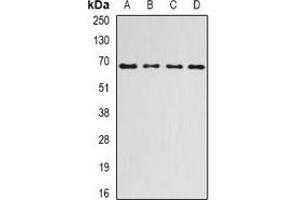 Western blot analysis of Ribophorin-1 expression in HepG2 (A), SKOV3 (B), mouse liver (C), rat liver (D) whole cell lysates. (RPN1 anticorps)