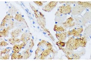 Immunohistochemistry of paraffin-embedded Rat heart using WSB2 Polyclonal Antibody at dilution of 1:100 (40x lens). (WSB2 anticorps)