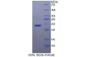 SDS-PAGE of Protein Standard from the Kit (Highly purified E.