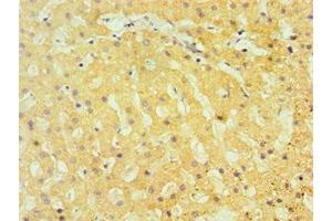 Immunohistochemistry of paraffin-embedded human liver tissue using ABIN7172813 at dilution of 1:100 (TBRG1 anticorps  (AA 22-150))