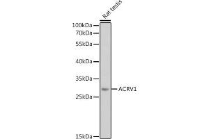 Western blot analysis of extracts of Rat testis, using  antibody (ABIN6129184, ABIN6136452, ABIN6136453 and ABIN6224123) at 1:1000 dilution. (ACRV1 anticorps  (AA 22-265))
