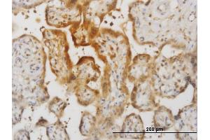 Immunoperoxidase of monoclonal antibody to IL15 on formalin-fixed paraffin-embedded human placenta.