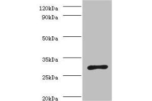 Western blot All lanes: ureA antibody at 2 μg/mL + Helicobacter pylori bacteria liquid Secondary Goat polyclonal to rabbit IgG at 1/10000 dilution Predicted band size: 27 kDa Observed band size: 27 kDa (Urea (AA 1-238) anticorps)