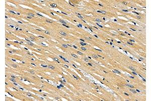 ABIN6261126 and ABIN6277912 at 1/100 staining Rat heart tissue by IHC-P. (CXCR1 anticorps  (N-Term))