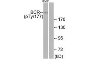 Western blot analysis of extracts from K562 cells, using Bcr (Phospho-Tyr177) Antibody. (BCR anticorps  (pTyr177))