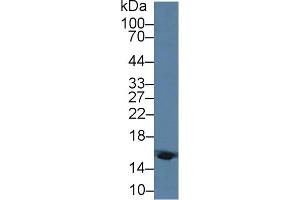 Detection of HBd in Human Blood Cells lysate using Polyclonal Antibody to Hemoglobin Delta (HBd) (HBd anticorps  (AA 1-143))