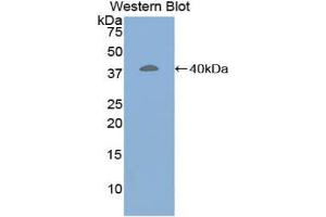 Western blot analysis of the recombinant protein. (Corin anticorps  (AA 70-136))
