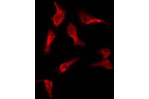 anti-OR2A4/7 antibody