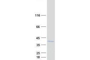 Validation with Western Blot