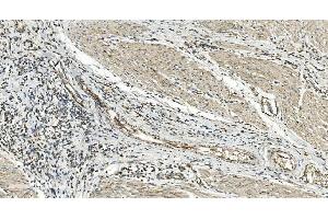 IHC analysis of FLCN using anti-FLCN antibody (ABIN7602491). (FLCN anticorps  (AA 8-551))