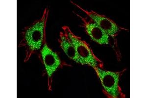 Fluorescent image of PC12 cells stained with Pink1 antibody.