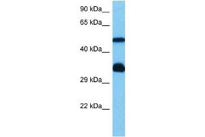 Host:  Mouse  Target Name:  HCLS1  Sample Tissue:  Mouse Heart  Antibody Dilution:  1ug/ml (HCLS1 anticorps  (N-Term))