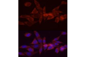 Immunofluorescence analysis of NIH/3T3 cells using DG Rabbit pAb (ABIN6134325, ABIN6139556, ABIN6139557 and ABIN6222582) at dilution of 1:200 (40x lens).