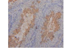 IHC-P analysis of Mouse Testis Tissue, with DAB staining. (ITLN1/Omentin anticorps  (AA 28-270))